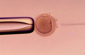 Fertility with In Vitro Fertilization