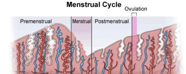 irregular menstrual cycle