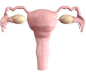 What is Polycystic Ovaries