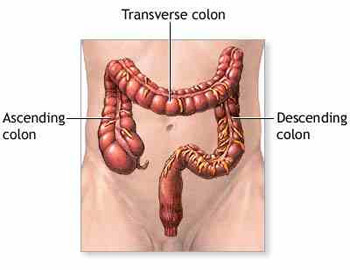 All-About-the-Stages-of-Colon-Cancer-in-Women