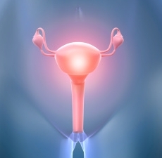 Stage 2 Ovarian Cancer Prognosis