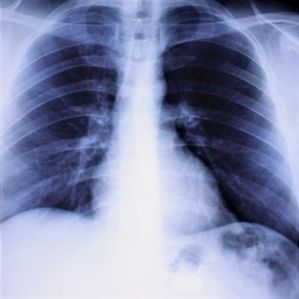 lung-disorders-and-diseases
