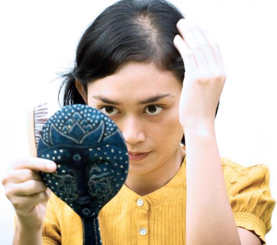 causes of bald spots among women