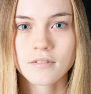 Iron Deficiency Anemia Symptoms