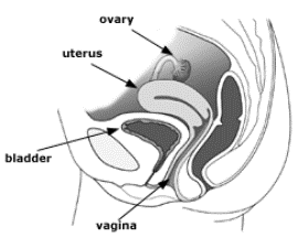 Prolapsed uterus