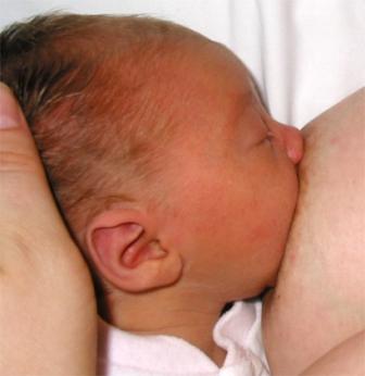 blocked duct during breast feeding