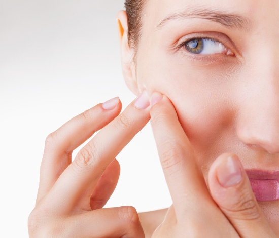 ways to treat menopausal acne