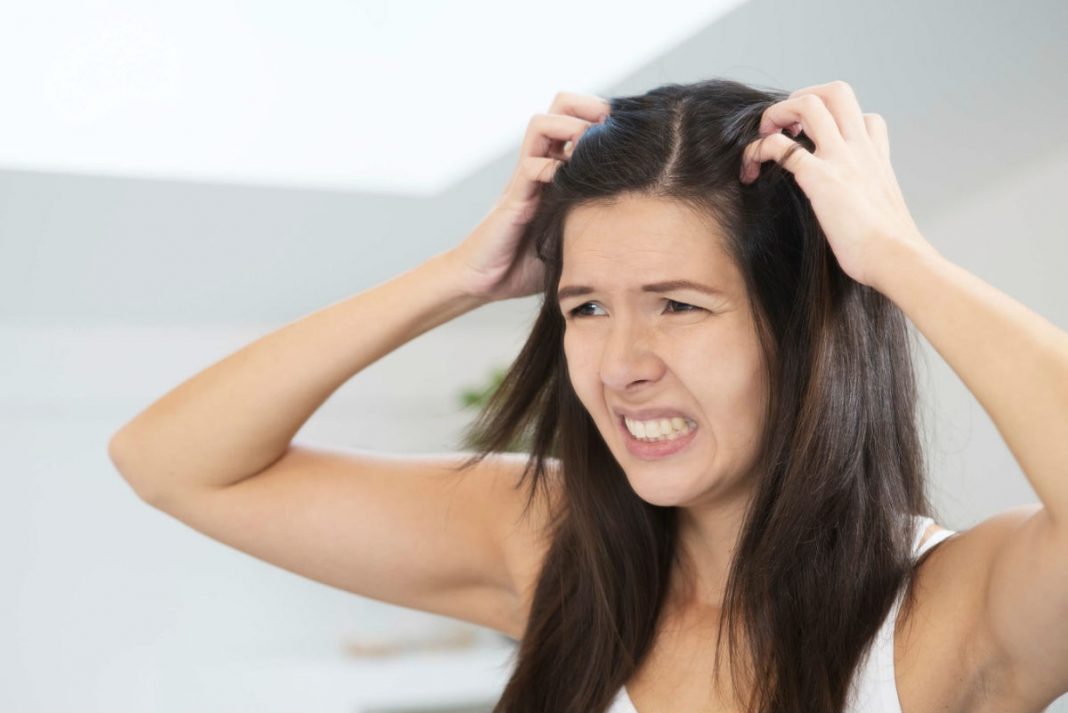 Simple Tips to Get Rid of Dry, Flaky Scalp